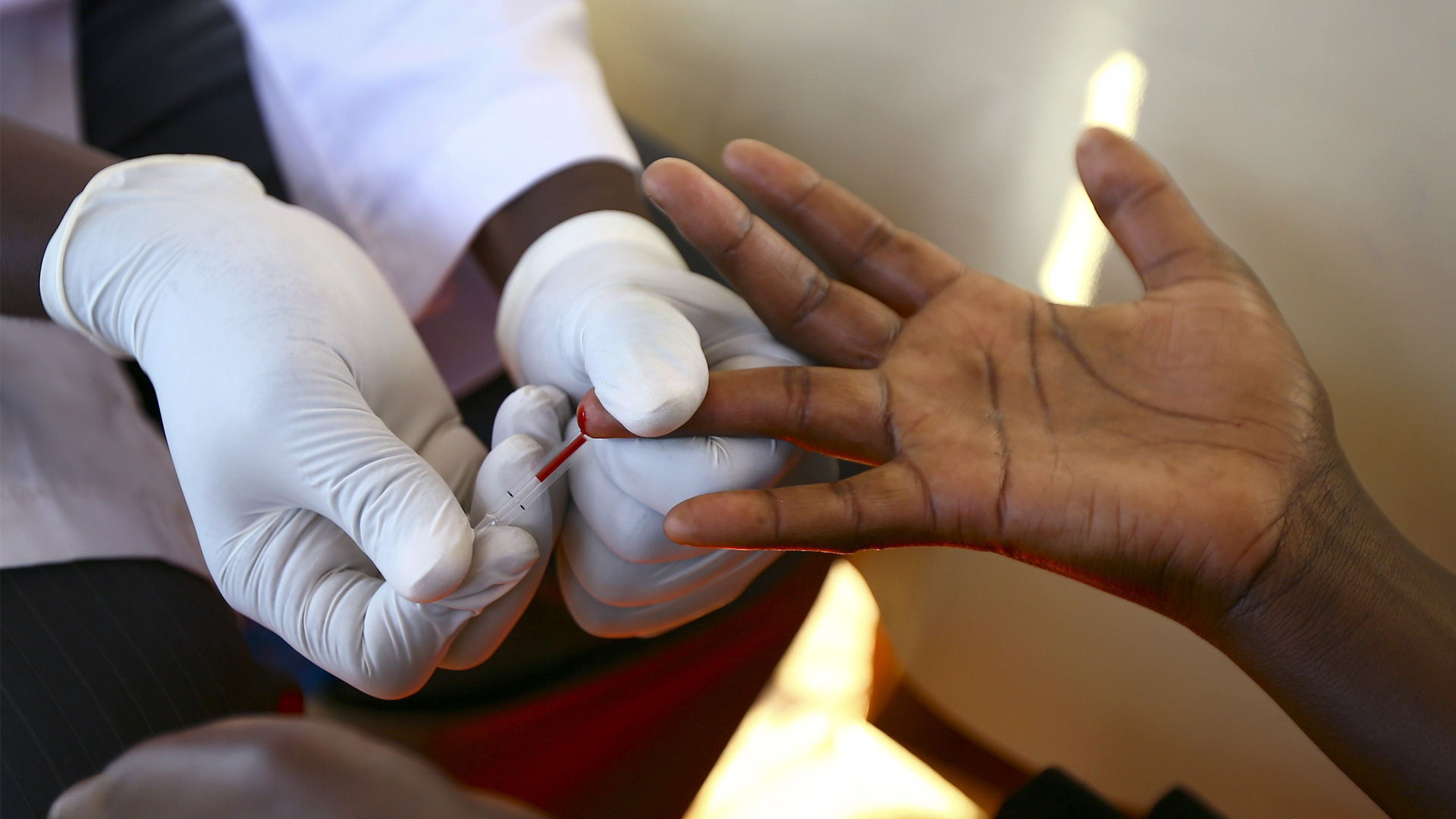 African blood test with sharp razor